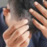 how to stop hair loss and regrow hair naturally