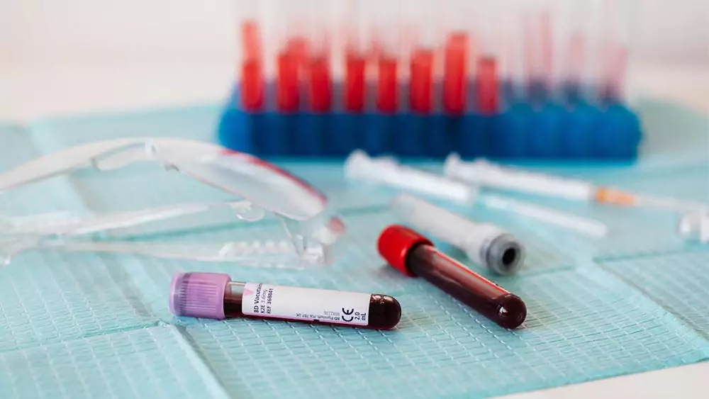 Blood test